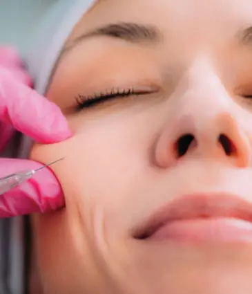 Binsina Laser Clinic - Dermal Fillers