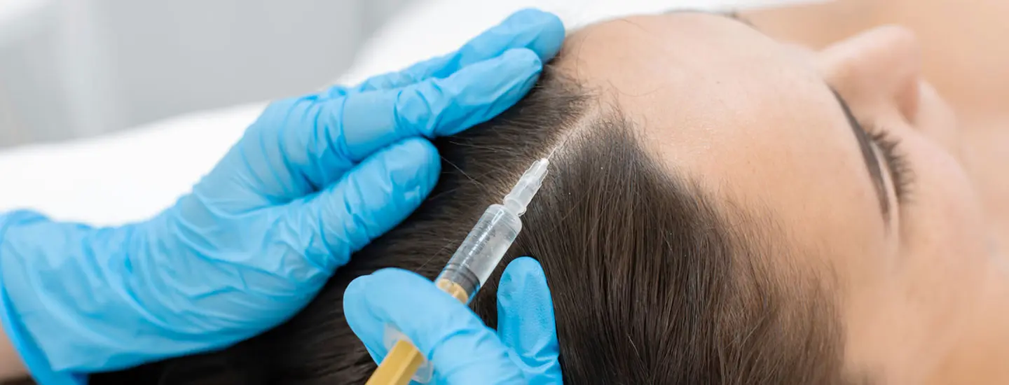 Binsina Skin & Laser Clinic - Hair Restoration (Plasma Therapy)