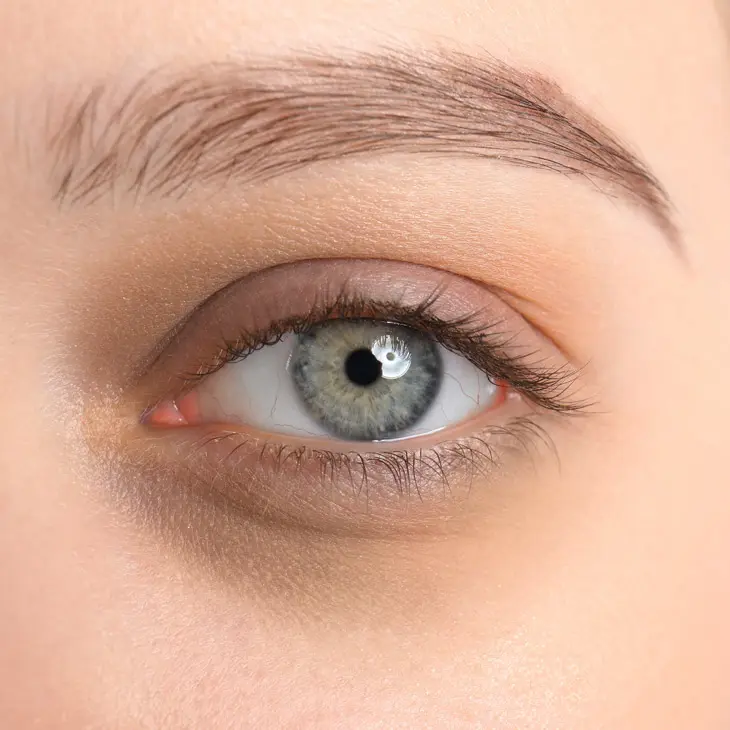 Binsina Skin & Laser Clinic - Dark Circles 3