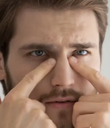Binsina Skin & Laser Clinic - Dark Circles