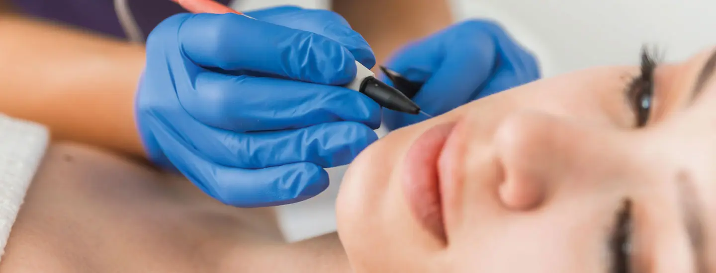Binsina Skin & Laser Clinic - Electrolysis