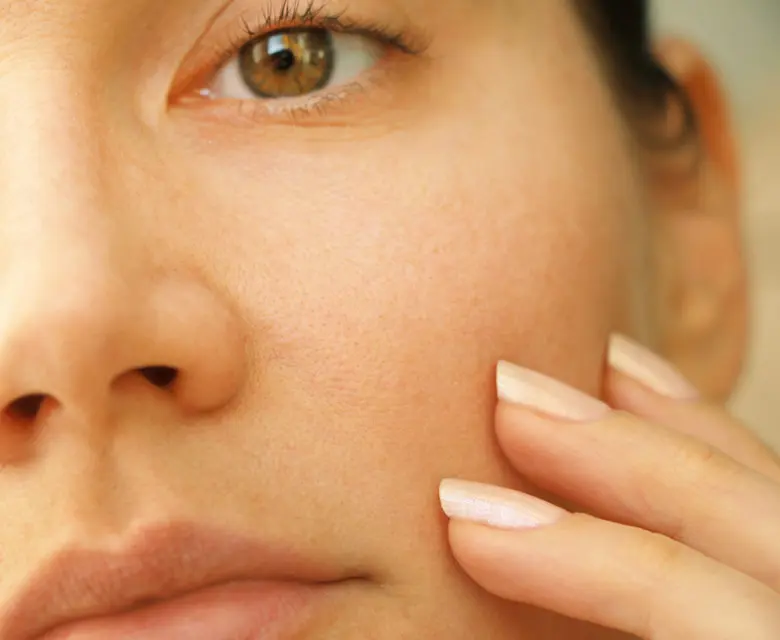 Binsina Skin & Laser Clinic - Large Pores