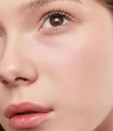 Binsina Skin & Laser Clinic - Laser Skin Rejuvenation 4
