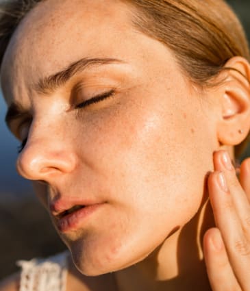 Binsina Skin & Laser Clinic - Sun Damage