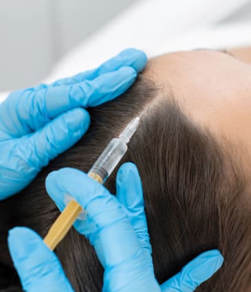 Binsina Skin & Laser Clinic - Hair Restoration (Plasma Therapy)