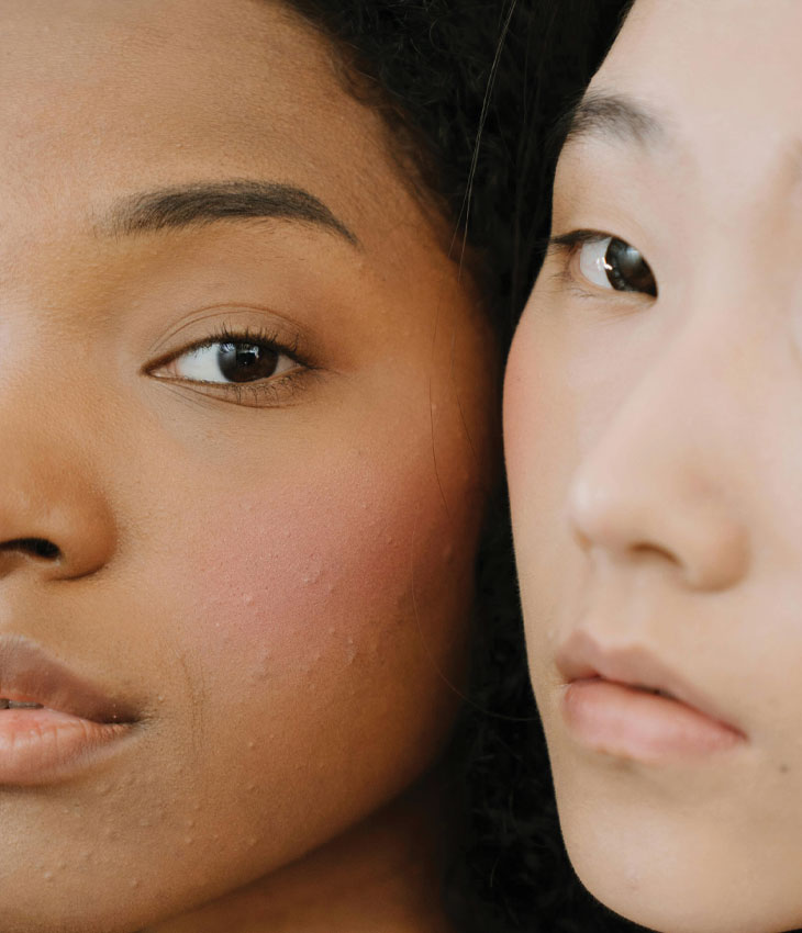 Binsina Laser Clinic - Laser Genesis 3