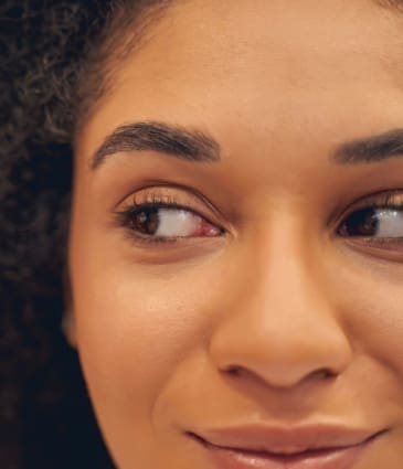 Binsina Laser Clinic - Laser Genesis