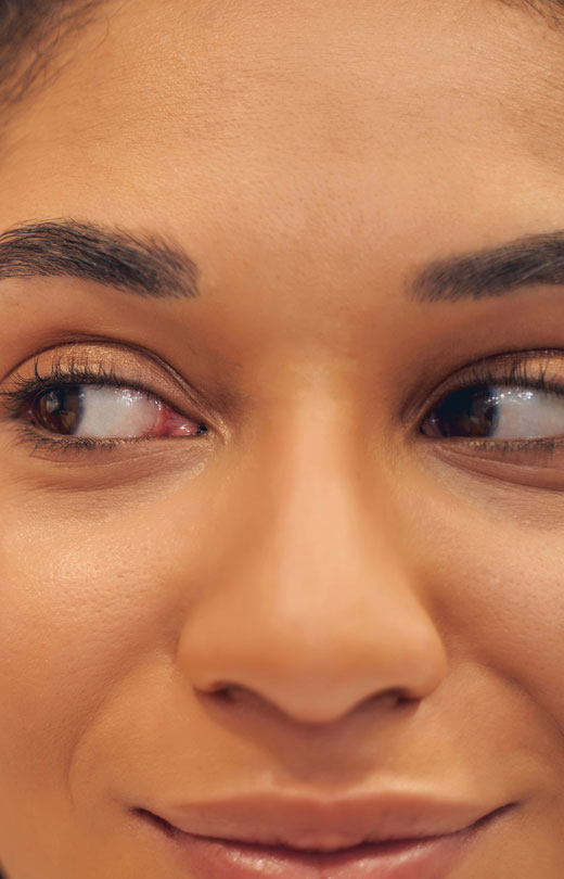 Binsina Laser Clinic - Laser Genesis