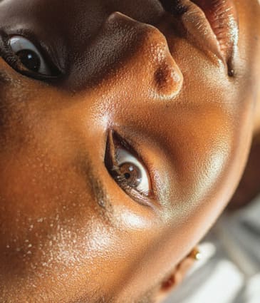 Binsina Laser Clinic - Lime Light Facial 4