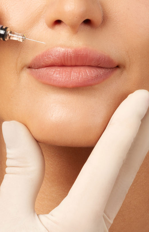 Binsina Laser Clinic - Lip Fillers