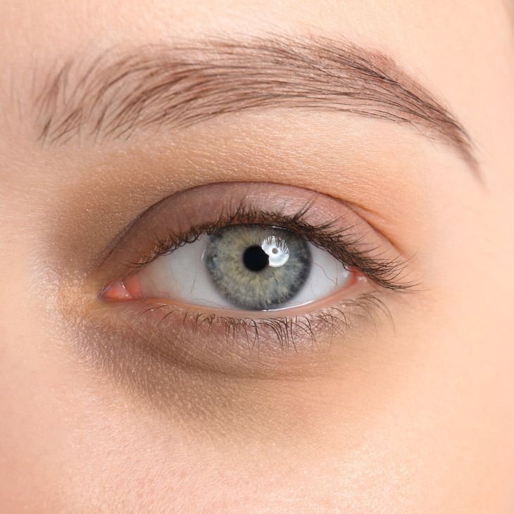 Binsina Skin & Laser Clinic - Dark Circles 3