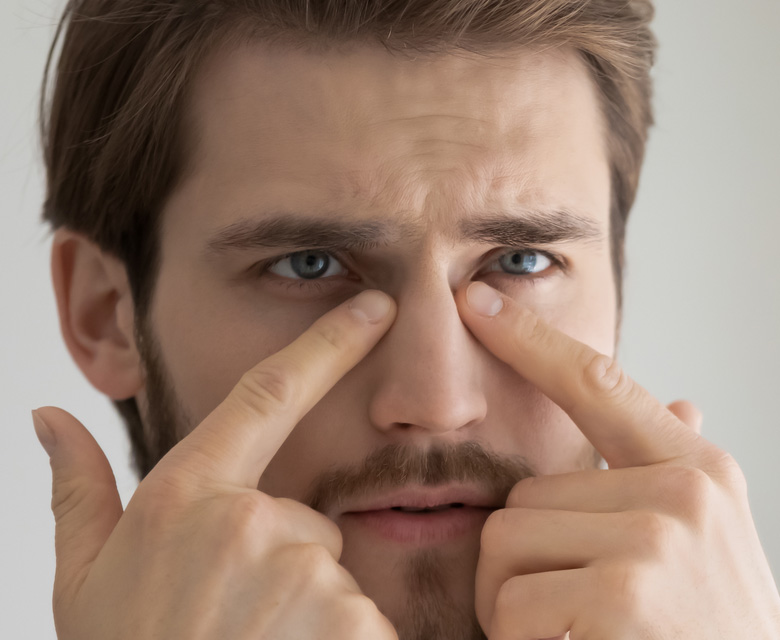 Binsina Skin & Laser Clinic - Dark Circles