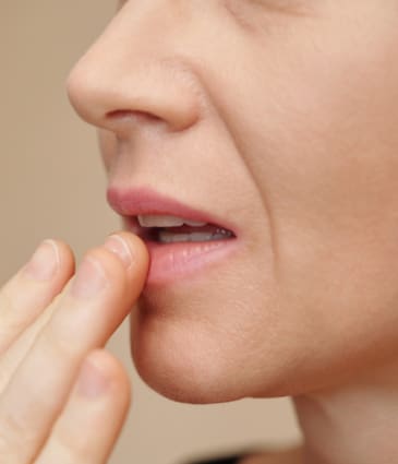 Binsina Skin & Laser Clinic - Dry Lips 2