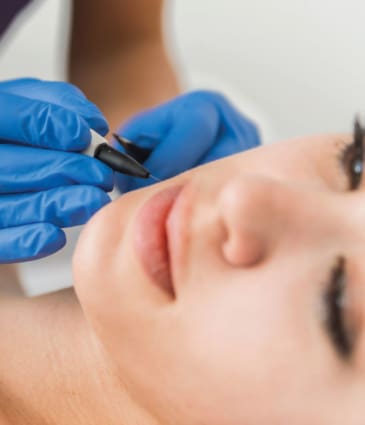 Binsina Skin & Laser Clinic - Electrolysis