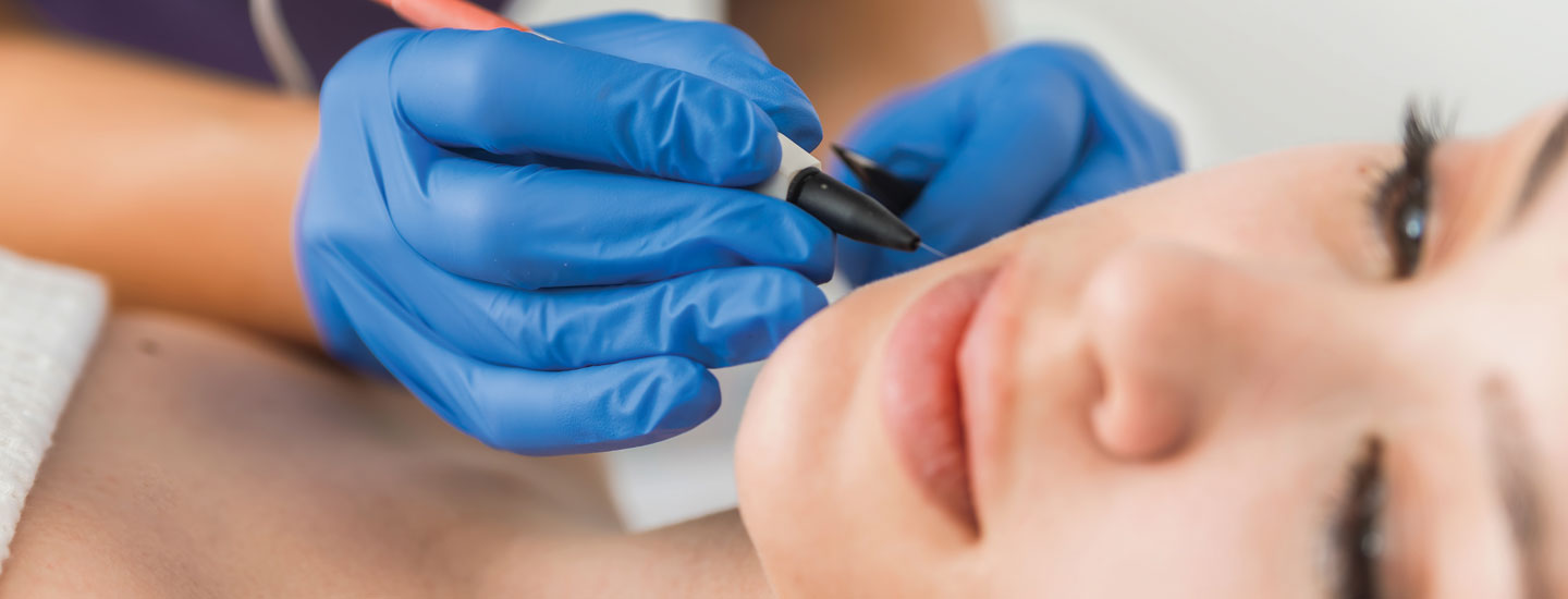 Binsina Skin & Laser Clinic - Electrolysis