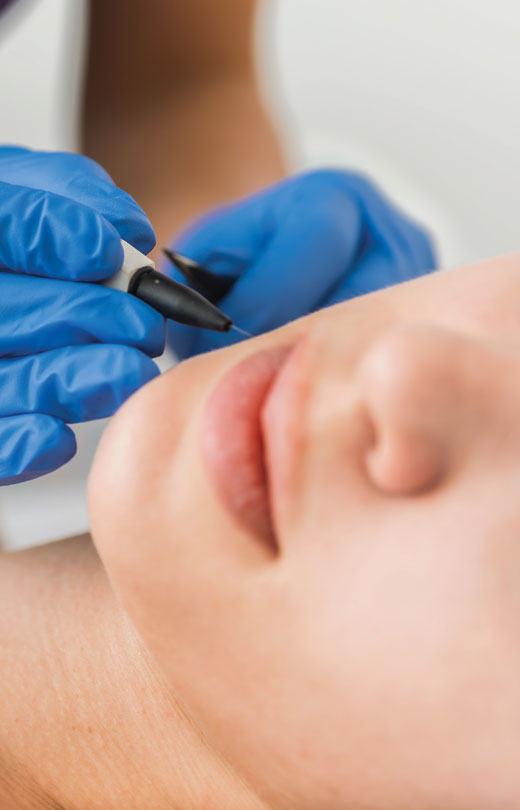 Binsina Skin & Laser Clinic - Electrolysis