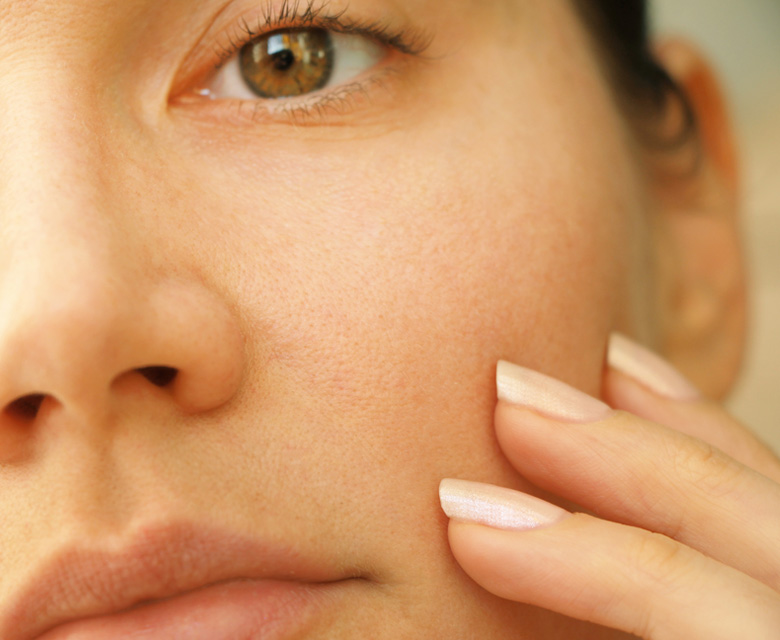 Binsina Skin & Laser Clinic - Large Pores