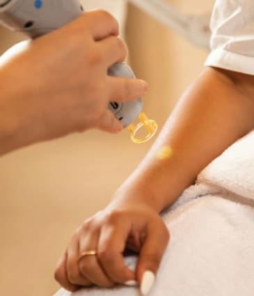 Binsina Skin & Laser Clinic - Laser Hair Reduction 4