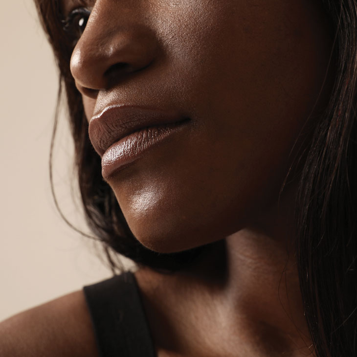 Binsina Skin & Laser Clinic - Laser Skin Rejuvenation 2