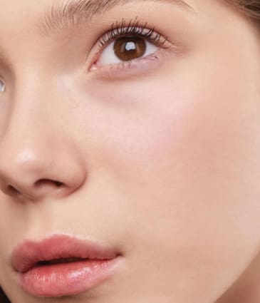 Binsina Skin & Laser Clinic - Laser Skin Rejuvenation 4