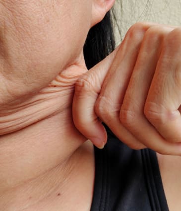 Binsina Skin & Laser Clinic - Lax Skin 2