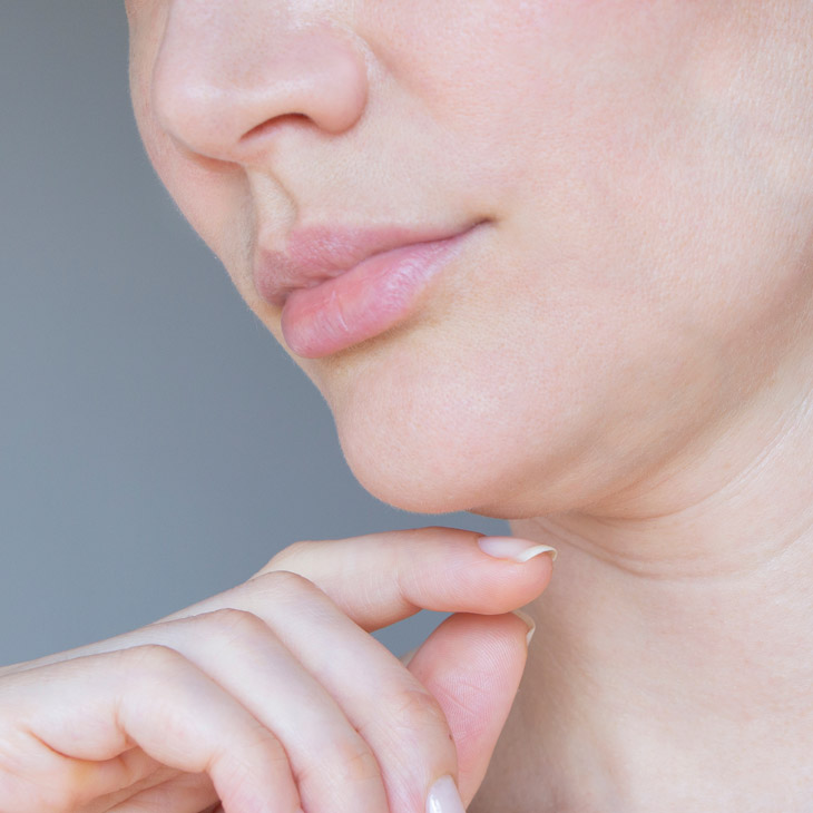 Binsina Skin & Laser Clinic - Lax Skin 3