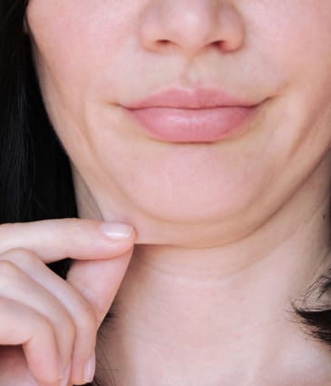 Binsina Skin & Laser Clinic - Lax Skin