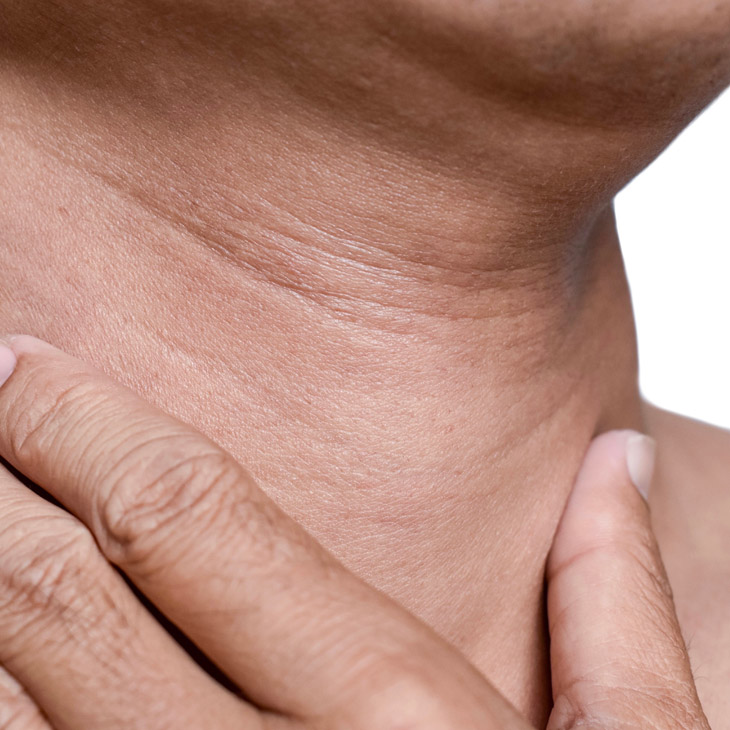 Binsina Skin & Laser Clinic - Neck Wrinkles 3