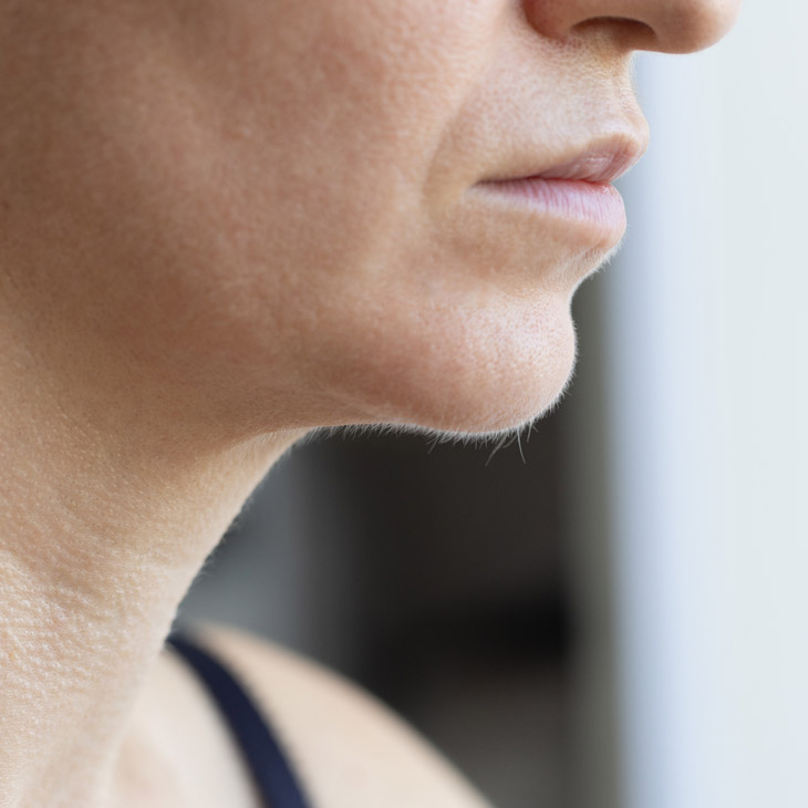 Binsina Skin & Laser Clinic - Unwanted - Excess Hair 3