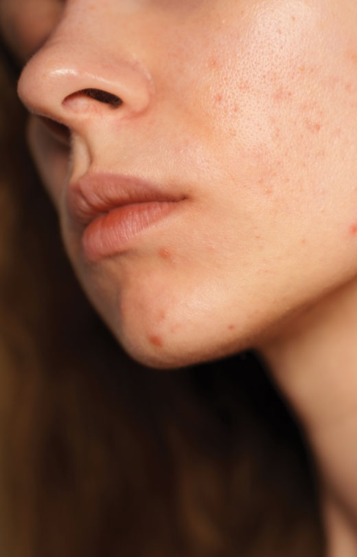 Binsina Skin & Laser Clinic - Conditions