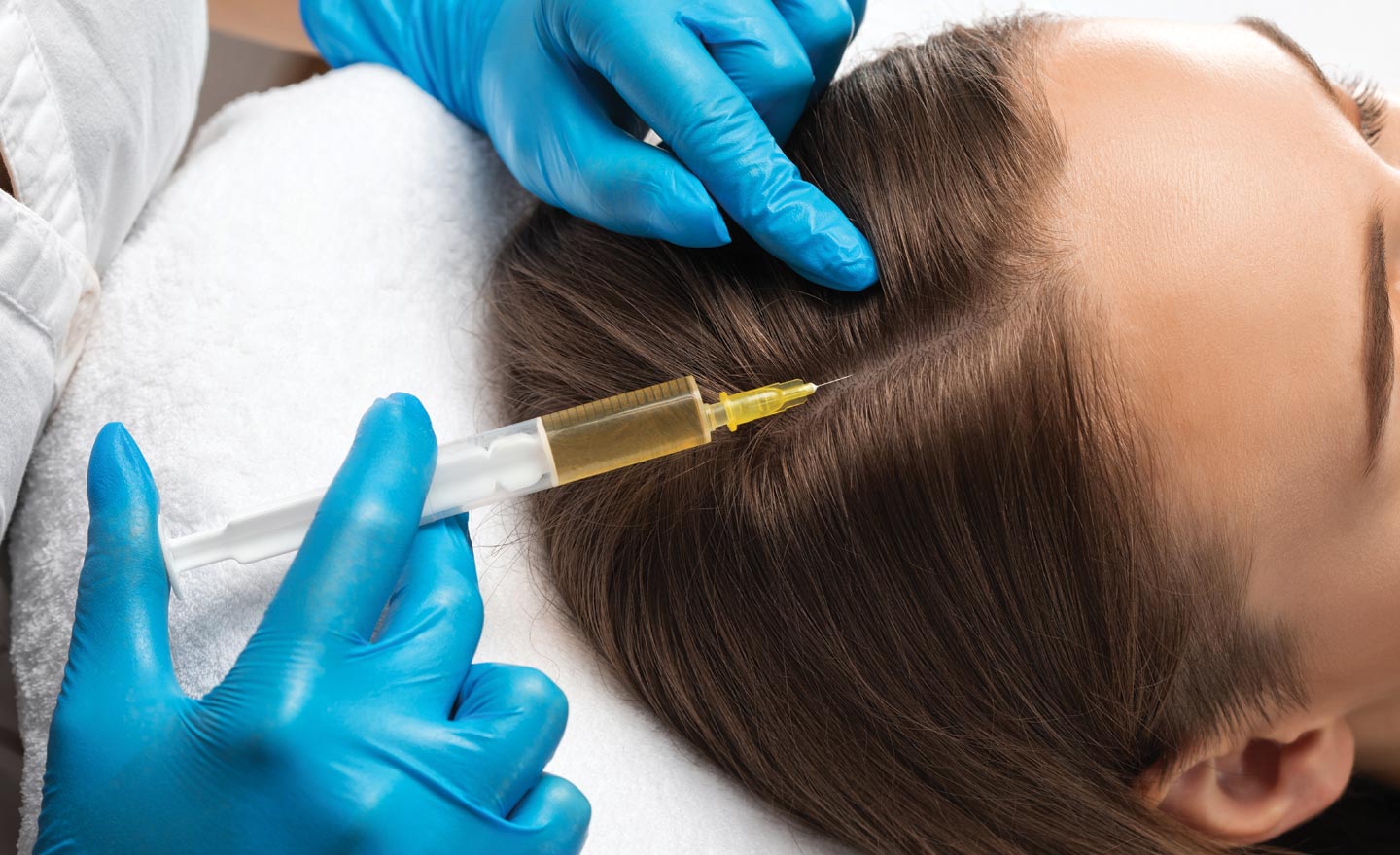 Binsina Skin & Laser Clinic - Why PRP Hair Restoration Is Transforming Confidence